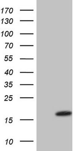 VIP Mouse anti-Human, Clone: OTI1E8, lyophilized, TrueMAB 100 &mu;g; Unconjugated:Antibodies,