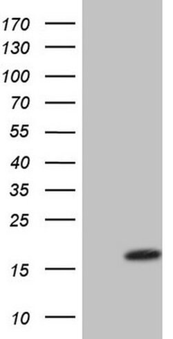 VIP Monoclonal Antibody (OTI1E8), TrueMAB , OriGene 100 &mu;L | Buy Online | Origene Technologies | Fisher Scientific