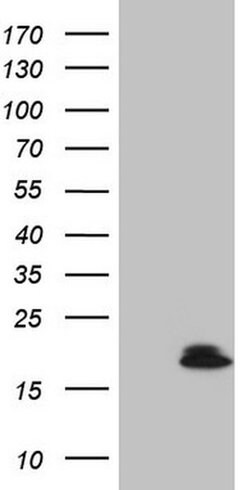 VIP Monoclonal Antibody (OTI5B5), TrueMAB , OriGene 100 &mu;L; Unconjugated:Antibodies,