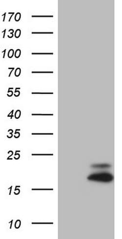 VIP Monoclonal Antibody (OTI1C2), TrueMAB , OriGene 100 &mu;L; Unconjugated:Antibodies,
