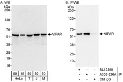 VIPAR Rabbit anti-Human, Mouse, Polyclonal, Bethyl Laboratories 100 &mu;L;