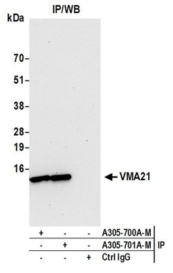 VMA21 Polyclonal Antibody, Bethyl Laboratories 20 &mu;L | Buy Online | Bethyl Laboratories, Inc | Fisher Scientific