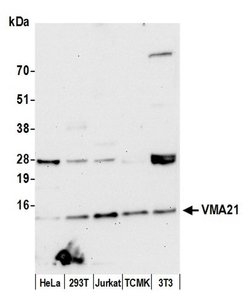 VMA21 Polyclonal Antibody, Bethyl Laboratories 20 &mu;L | Buy Online | Bethyl Laboratories, Inc | Fisher Scientific