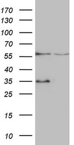 VPS13B Monoclonal Antibody (OTI6F6), TrueMAB , OriGene:Antibodies:Primary