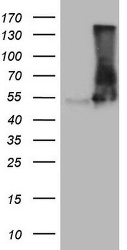 VPS13B Monoclonal Antibody (OTI6D1), TrueMAB , OriGene 100 &mu;L | Buy Online | Origene Technologies | Fisher Scientific