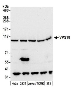 VPS18 Polyclonal Antibody, Bethyl Laboratories 20 &mu;L; Unconjugated:Antibodies,