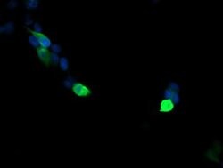 VPS28 Mouse anti-Canine, Human, Mouse, Rat, Clone: OTI1A8, liquid, TrueMAB