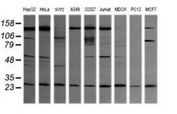 VPS28 Mouse anti-Canine, Human, Mouse, Rat, Clone: OTI1A8, liquid, TrueMAB