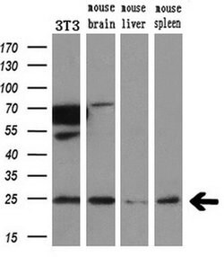 VPS28 Mouse anti-Canine, Human, Mouse, Rat, Clone: OTI1A8, liquid, TrueMAB