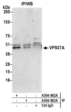 VPS37A Rabbit anti-Human, Polyclonal, Bethyl Laboratories 10 &mu;L; Unconjugated:Antibodies,