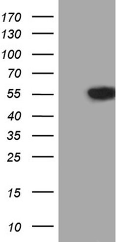 VRK2 Monoclonal Antibody (OTI2A2), TrueMAB , OriGene 100 &mu;L; Unconjugated:Antibodies,