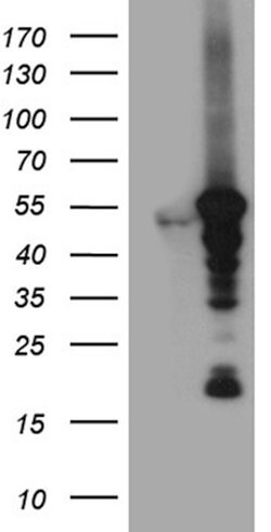 VRK2 Mouse anti-Human, Clone: OTI8H5, lyophilized, TrueMAB 100 &mu;g; Unconjugated:Antibodies,