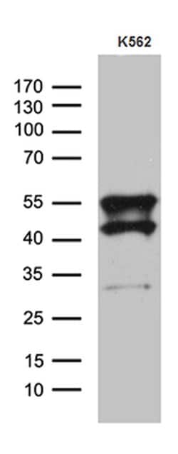 VRK2 Mouse anti-Human, Clone: OTI8H5, lyophilized, TrueMAB 100 &mu;g; Unconjugated:Antibodies,