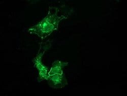 VSIG2 Monoclonal Antibody (OTI11B3), TrueMAB , OriGene 100 &mu;L; Unconjugated:Antibodies,