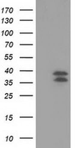 VSIG2 Monoclonal Antibody (OTI1H2), TrueMAB , OriGene 30 &mu;L; Unconjugated:Antibodies,