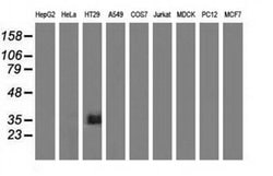 VSIG2 Monoclonal Antibody (OTI1H2), TrueMAB , OriGene 30 &mu;L; Unconjugated:Antibodies,