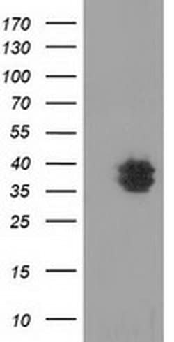 VSIG2 Monoclonal Antibody (OTI11B3), TrueMAB , OriGene 100 &mu;L; Unconjugated:Antibodies,