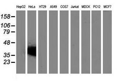 VSIG2 Mouse anti-Human, Clone: OTI11B3, lyophilized, TrueMAB 100 &mu;g | Buy Online | Origene Technologies | Fisher Scientific