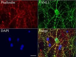VSNL1 Mouse anti-Human, Clone: UMAB115, lyophilized, UltraMAB 100 &mu;g;