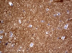 VSNL1 Monoclonal Antibody (OTI1G10), TrueMAB , OriGene 100 &mu;L; Unconjugated:Antibodies,