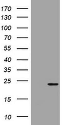 VSNL1 Monoclonal Antibody (OTI5C3), TrueMAB , OriGene:Antibodies:Primary