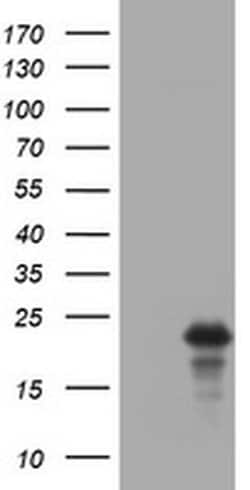 VSNL1 Monoclonal Antibody (OTI2E5), TrueMAB , OriGene 100 &mu;L; Unconjugated:Antibodies,