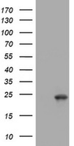 VSNL1 Monoclonal Antibody (OTI7D11), TrueMAB , OriGene 100 &mu;L; Unconjugated:Antibodies,