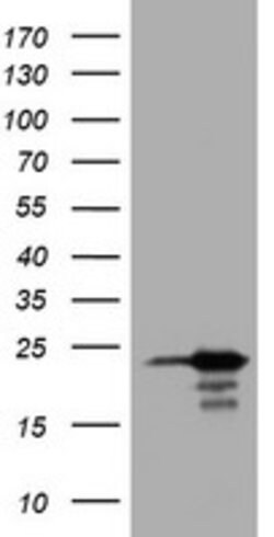 VSNL1 Mouse anti-Human, Clone: OTI4G1, lyophilized, TrueMAB 100 &mu;g;