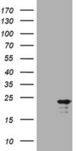 VSNL1 Mouse anti-Human, Clone: OTI1B10, lyophilized, TrueMAB 100 &mu;g;