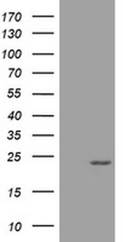 VSNL1 Monoclonal Antibody (OTI5B10), TrueMAB , OriGene 30 &mu;L; Unconjugated:Antibodies,