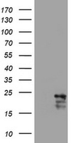 VSNL1 Monoclonal Antibody (OTI7E11), TrueMAB , OriGene 30 &mu;L | Buy Online | Origene Technologies | Fisher Scientific