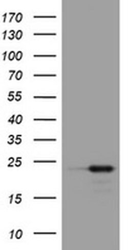 VSNL1 Monoclonal Antibody (OTI5C8), TrueMAB , OriGene 100 &mu;L; Unconjugated:Antibodies,