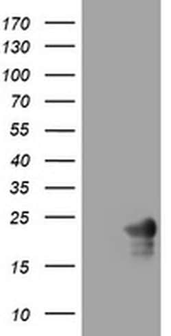 VSNL1 Monoclonal Antibody (OTI2B10), TrueMAB , OriGene 100 &mu;L; Unconjugated:Antibodies,