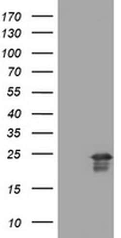 VSNL1 Monoclonal Antibody (OTI3A1), TrueMAB , OriGene 100 &mu;L; Unconjugated:Antibodies,