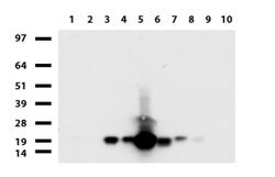 VSNL1 Mouse anti-Human, Clone: UMAB115, lyophilized, UltraMAB 100 &mu;g;