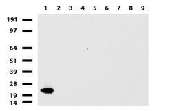 VSNL1 Mouse anti-Human, Clone: UMAB116, liquid, UltraMAB 30 &mu;L; Unconjugated:Antibodies,