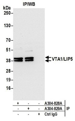 VTA1/LIP5 Rabbit anti-Human, Polyclonal, Bethyl Laboratories 100 &mu;L;
