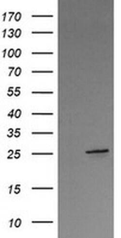 VTI1A Monoclonal Antibody (OTI1E3), TrueMAB , OriGene 100 &mu;L; Unconjugated:Antibodies,