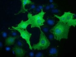 VWA5A Mouse anti-Human, Clone: OTI1E9, lyophilized, TrueMAB 100 &mu;g;