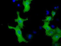 VWA5A Monoclonal Antibody (OTI2C6), TrueMAB , OriGene 100 &mu;L; Unconjugated:Antibodies,