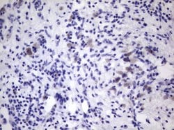 VWF Mouse anti-Human, Clone: OTI9F3, lyophilized, TrueMAB 100 &mu;g; Unconjugated:Antibodies,