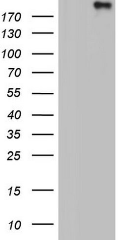 VWF Monoclonal Antibody (OTI2D10), TrueMAB , OriGene 100 &mu;L; Unconjugated:Antibodies,