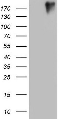 VWF Monoclonal Antibody (OTI2F2), TrueMAB , OriGene 100 &mu;L; Unconjugated:Antibodies,