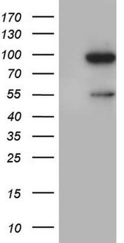VWF Monoclonal Antibody (OTI8A6), TrueMAB , OriGene 30 &mu;L; Unconjugated:Antibodies,