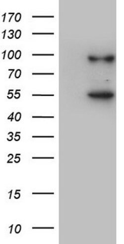 VWF Mouse anti-Human, Clone: OTI1D4, lyophilized, TrueMAB 100 &mu;g; Unconjugated:Antibodies,