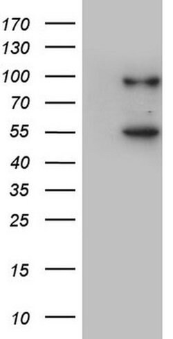 VWF Monoclonal Antibody (OTI1D4), TrueMAB , OriGene:Antibodies:Primary
