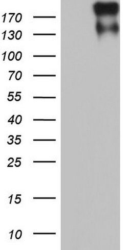 VWF Mouse anti-Human, Clone: OTI9F3, lyophilized, TrueMAB 100 &mu;g; Unconjugated:Antibodies,