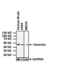 Invitrogen Vimentin Monoclonal Antibody (J144) 200 &mu;L; Unconjugated:Anticorps,