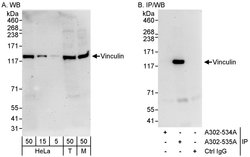 Vinculin Rabbit anti-Human, Mouse, Polyclonal, Bethyl Laboratories 100