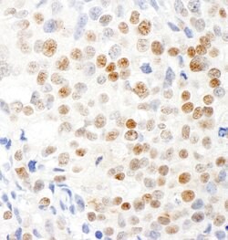 Virilizer Rabbit anti-Human, Polyclonal, Bethyl Laboratories 100 &mu;l;